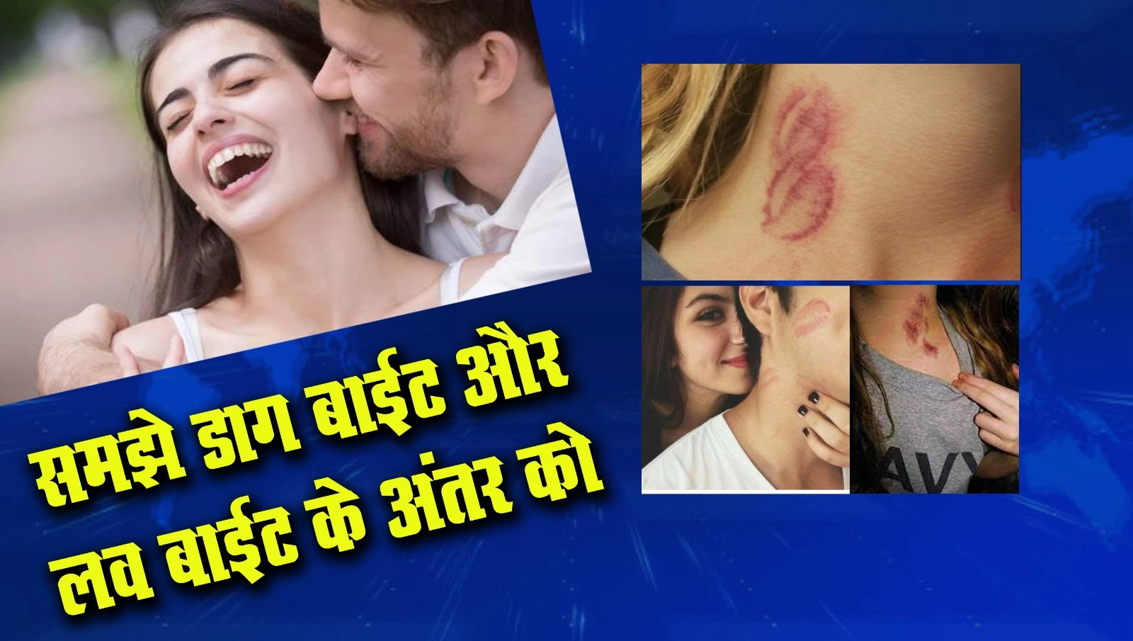 समझे डॉग बाइट और लव बाइट के अंदर को